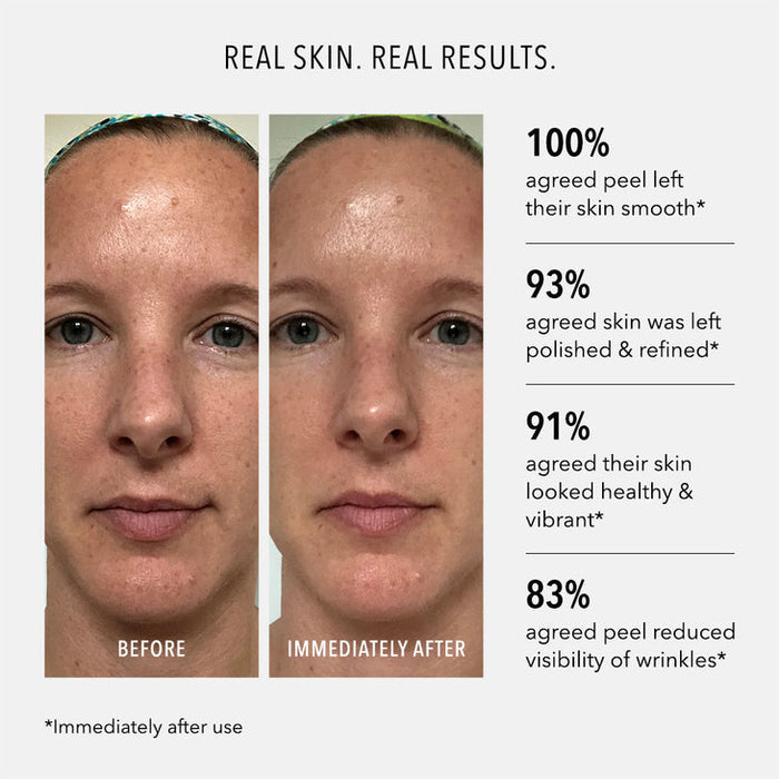 Before and immediately after comparison of a woman's face showing smoother, polished, and more vibrant skin results from using the Polish & Plump Face Peel Kit | HydroPeptide, with statistics on skin improvement.