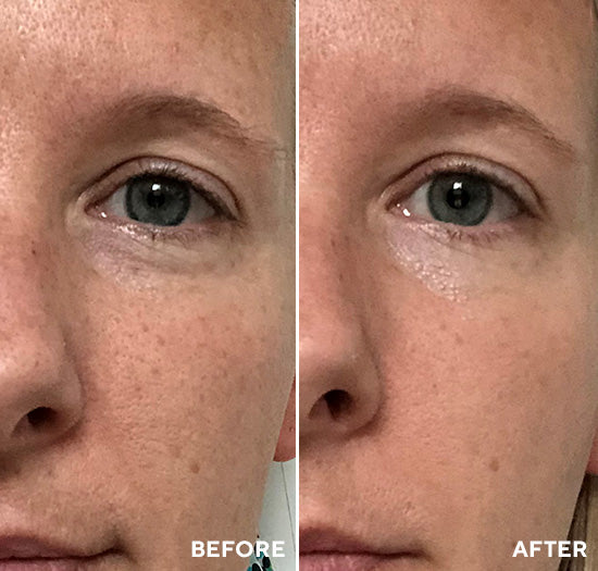 Close-up side-by-side comparison of a woman's face before and after using Polish & Plump Face Peel Kit | HydroPeptide, showing smoother and more radiant skin texture.