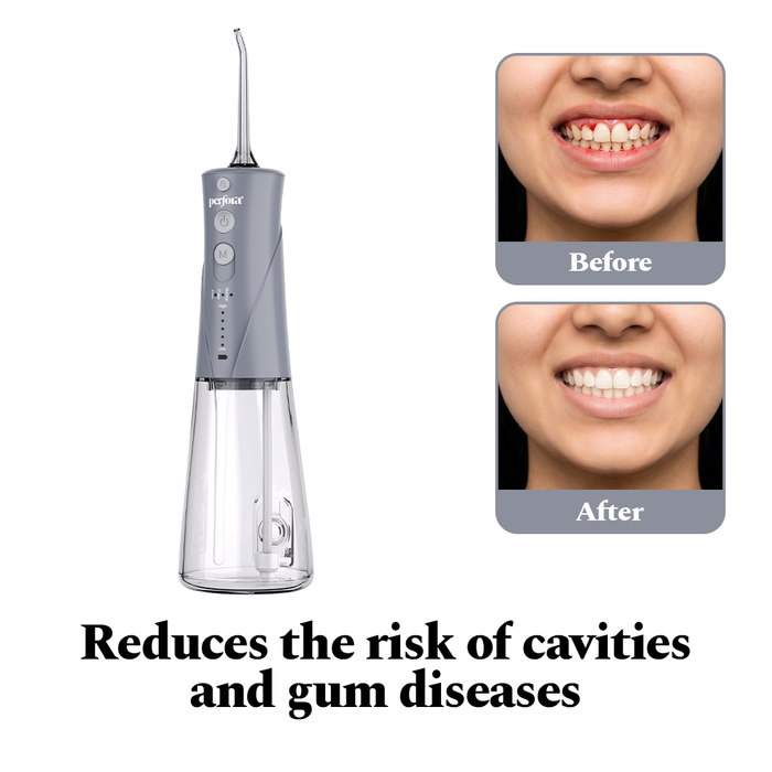 Power Dental Flosser